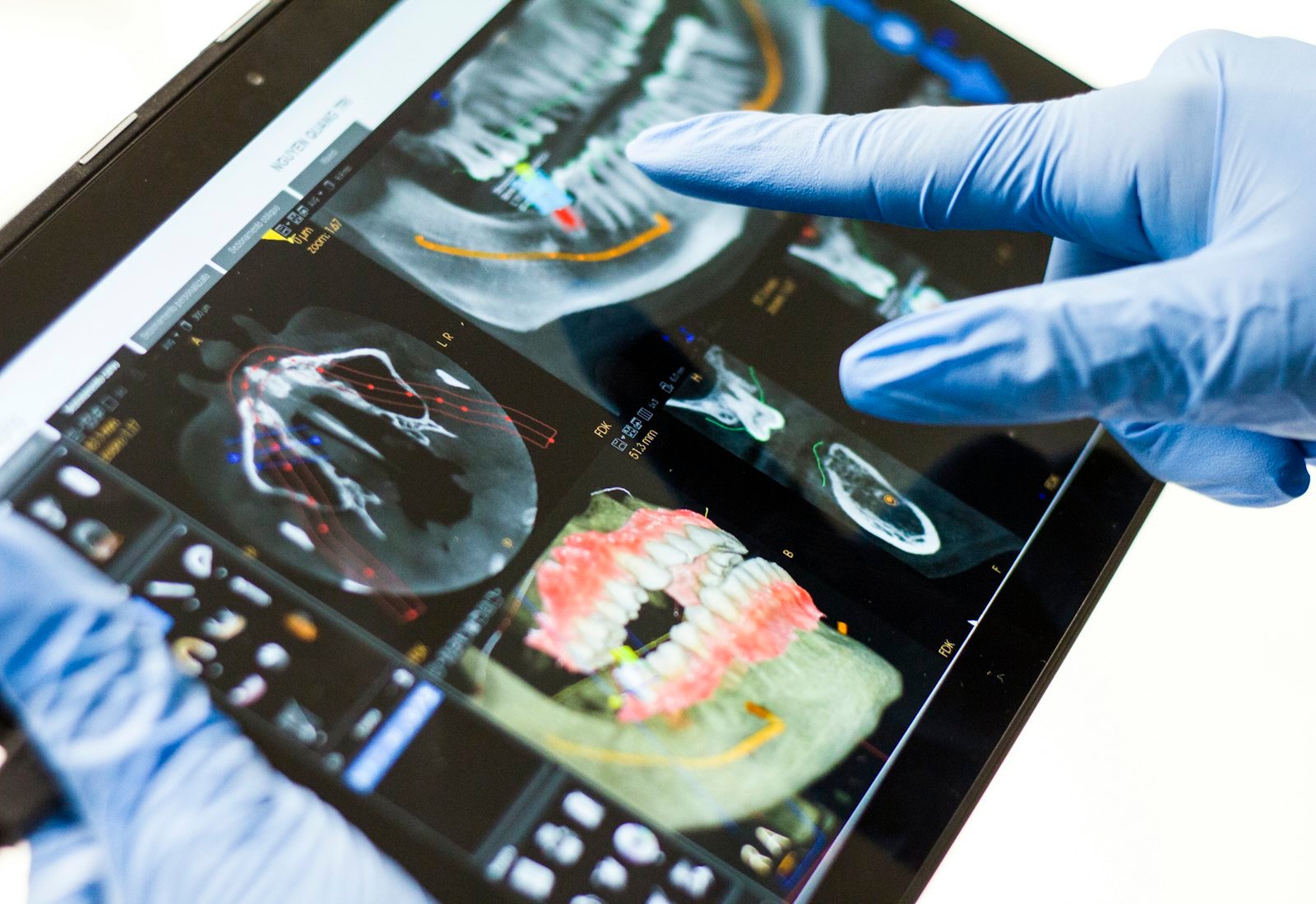 Especialista revisando una tomografía dental en una tableta
